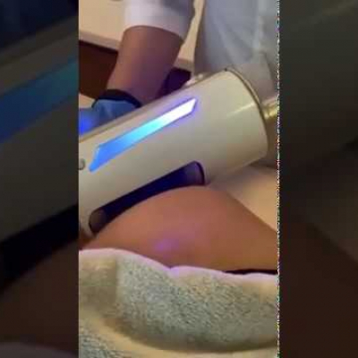 Эндосфера терапия - Антицеллюлитный Массаж тела. Видео процедуры. Салон Beauty laser в Чернигов