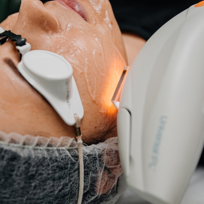 Фотоомолодження Lumenis M22