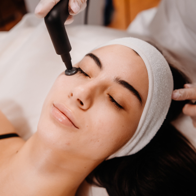 RF ліфтинг повік