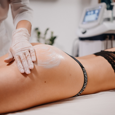 RF лифтинг ягодиц