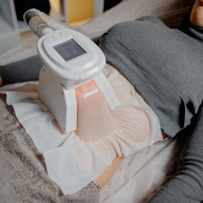 Кріоліполіз 