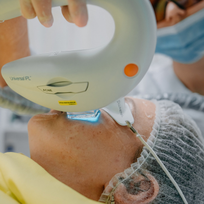 Лікування акне Lumenis M22