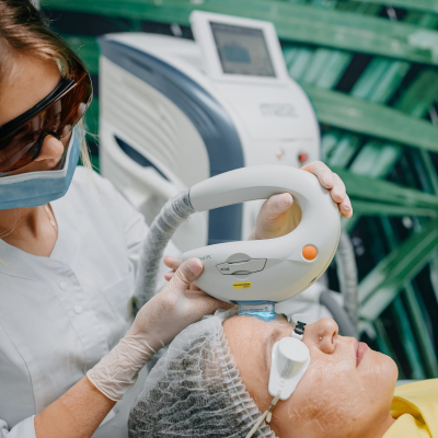 Лазерне лікування акне