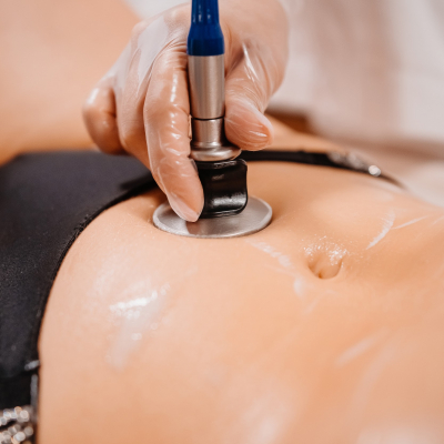 Рф ліфтинг живота Indiba