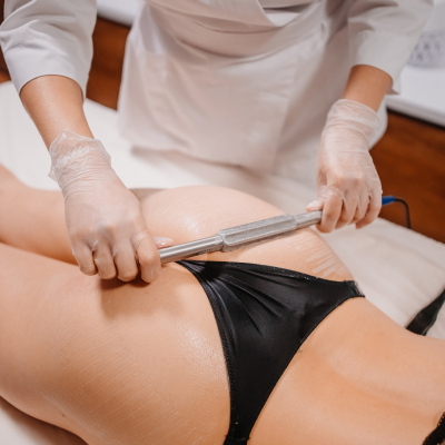 RF ліфтинг тіла