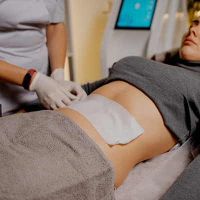 Кріоліполіз 