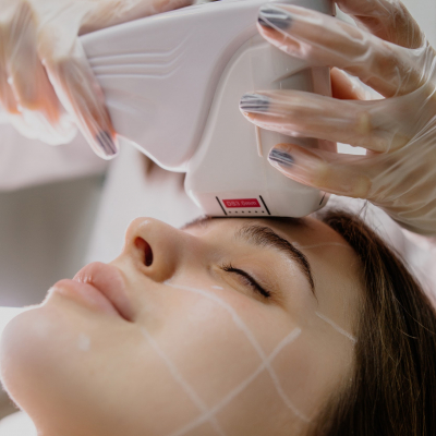 SMAS ліфтинг обличчя