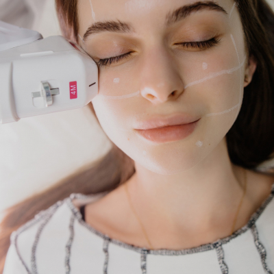 SMAS ліфтинг Київ