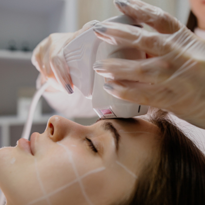 СМАС ліфтинг обличчя