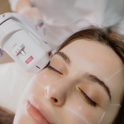 SMAS ліфтинг обличчя