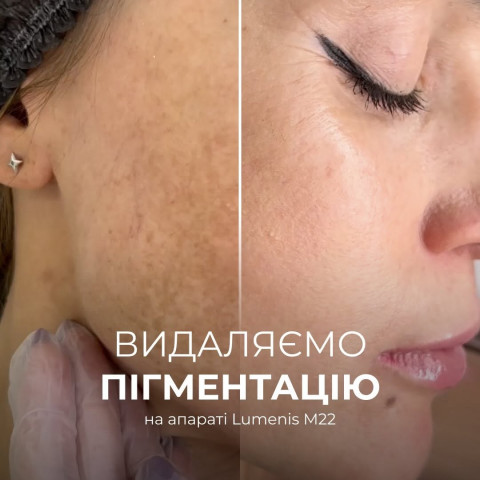 Изображение из Instagram