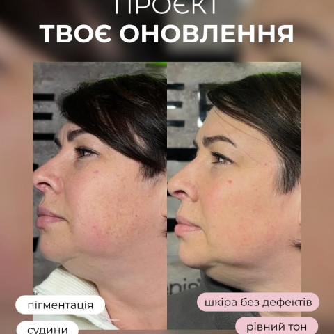 Изображение из Instagram