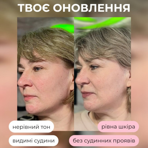 Изображение из Instagram