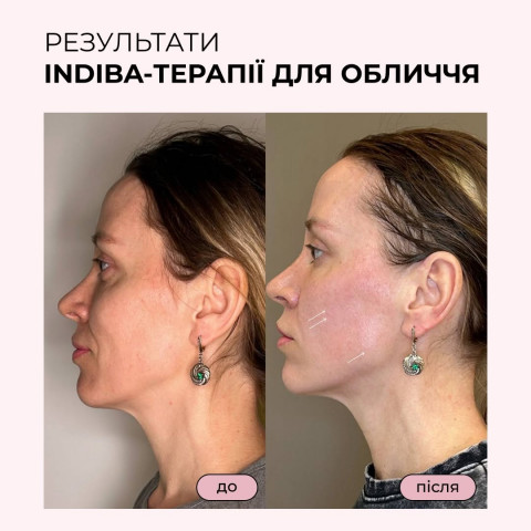 Изображение из Instagram