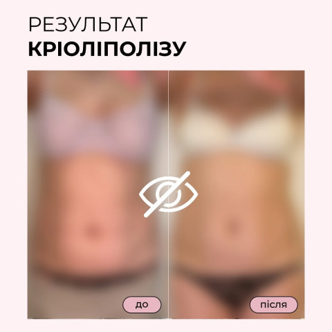 Изображение из Instagram