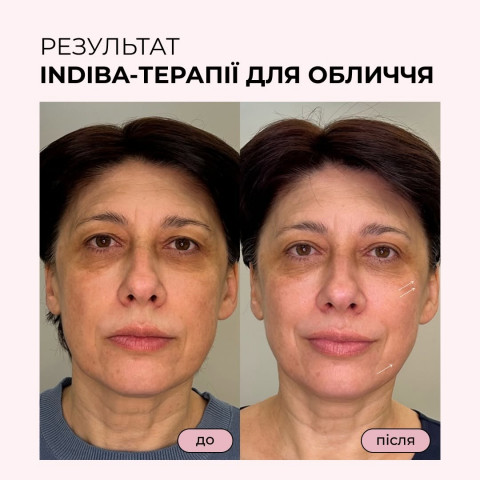 Изображение из Instagram