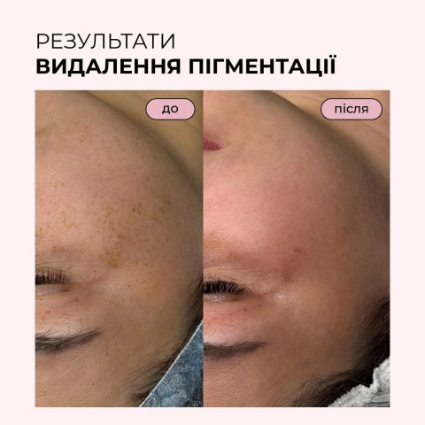 Изображение из Instagram